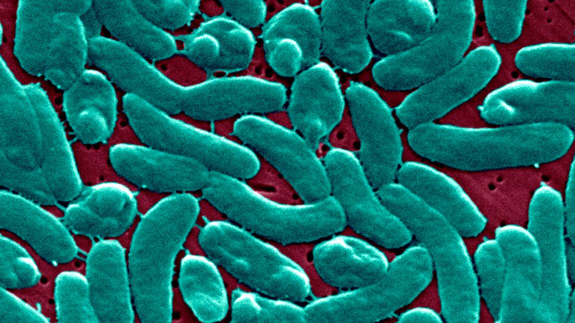 Florida Man’s Vibrio Vulnificus Infection Devours Arm And Leg In Three Days