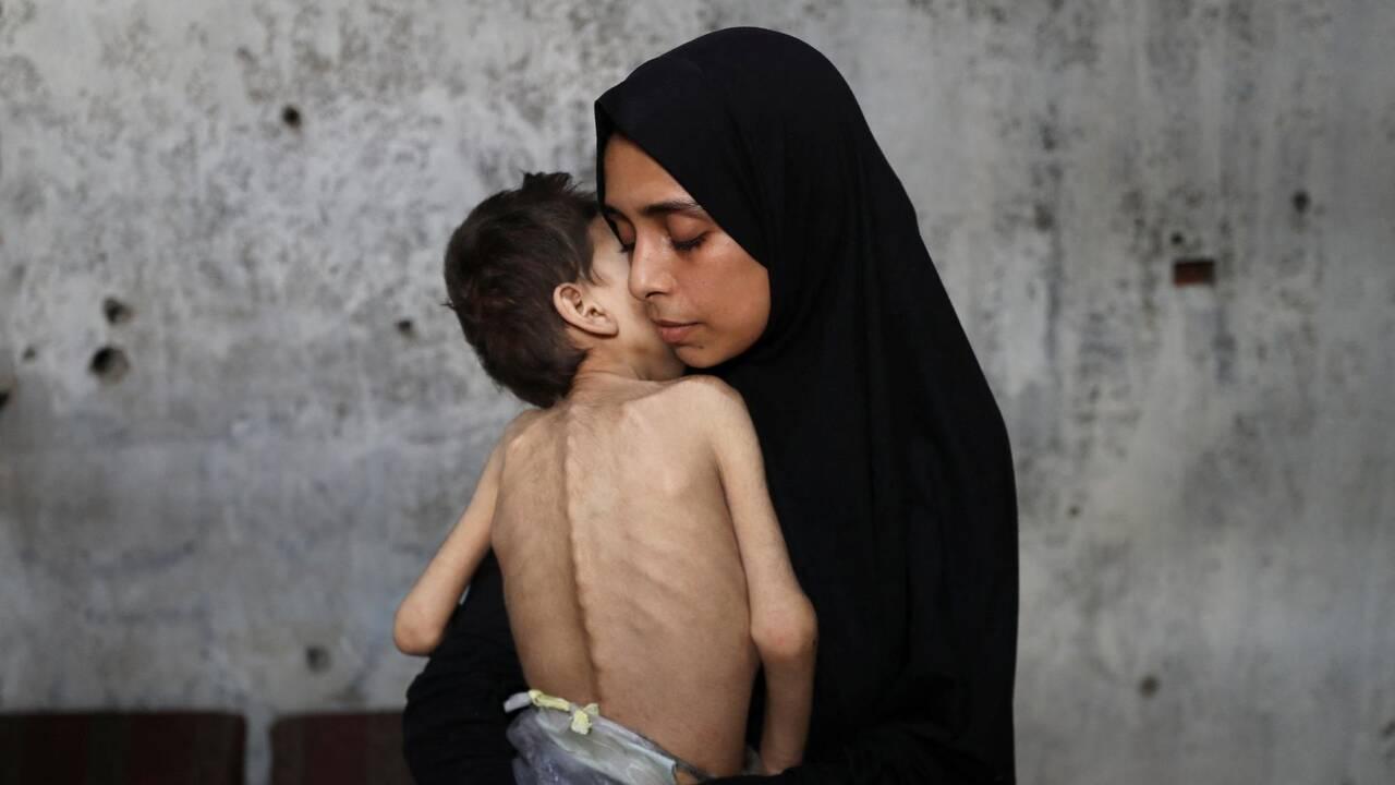 Israel Bombs Gaza Hospitals, Razes Cities, Displacing Palestinians as Famine Spreads
