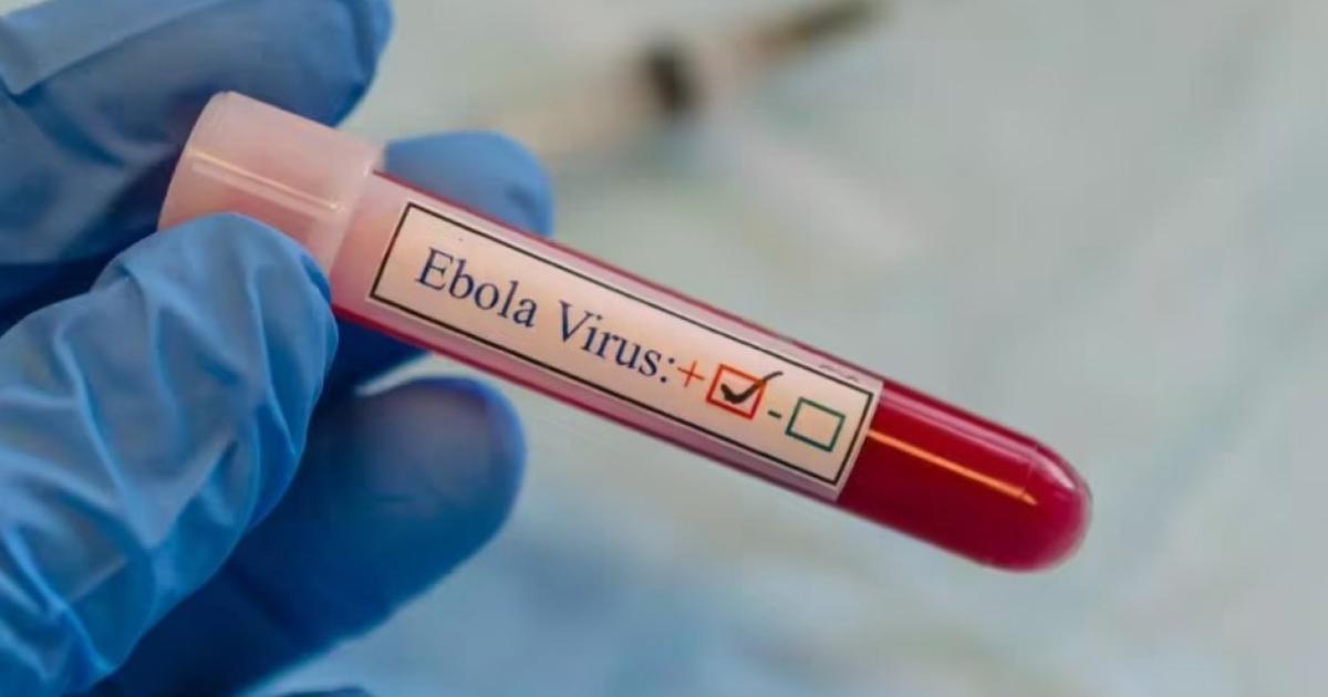 U.S. Health Officials Assess Americans’ Ebola Exposure in Democratic Republic of Congo Outbreak