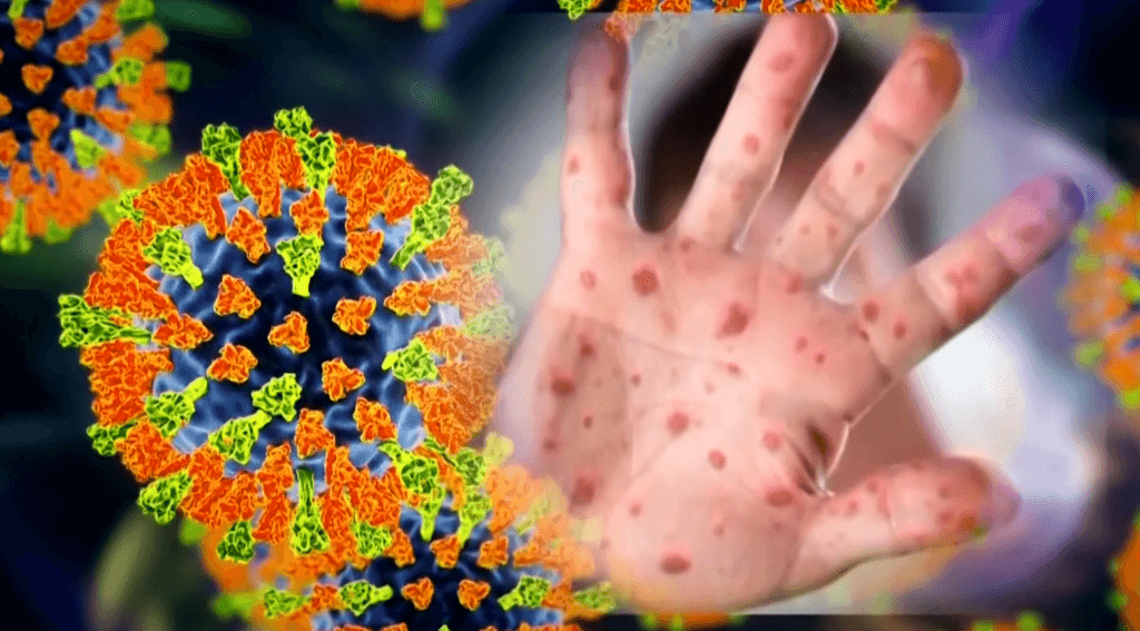 Kathy Hochul Declares New York State Disaster Emergency Over Measles Outbreak