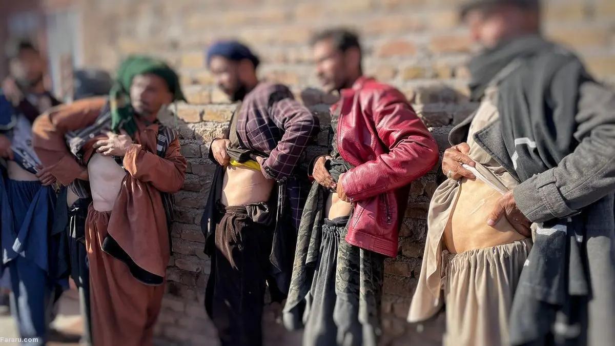 Afghan Families Sell Children And Body Parts To Survive Hunger In Ghor Province
