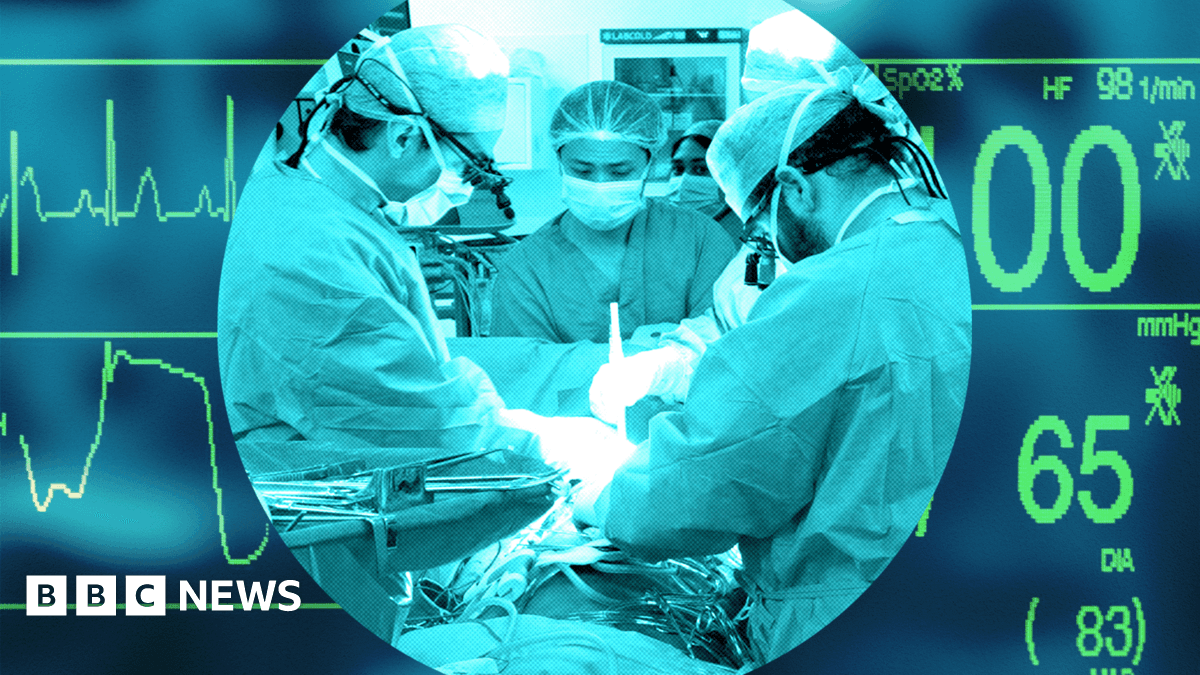 UK's transplant system was world-leading - now it lags behind other Western nations