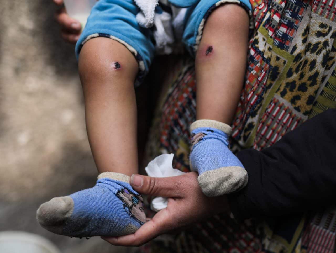 Israeli Soldiers Torture One-Year-Old Near Al-Maghazi to Force Father's Confession