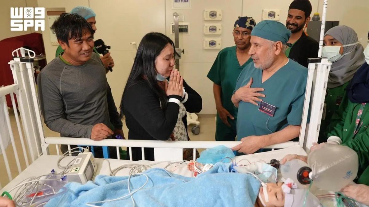 Saudi Doctors Successfully Separate Filipino Conjoined Twins Olivia and Gianna in Riyadh