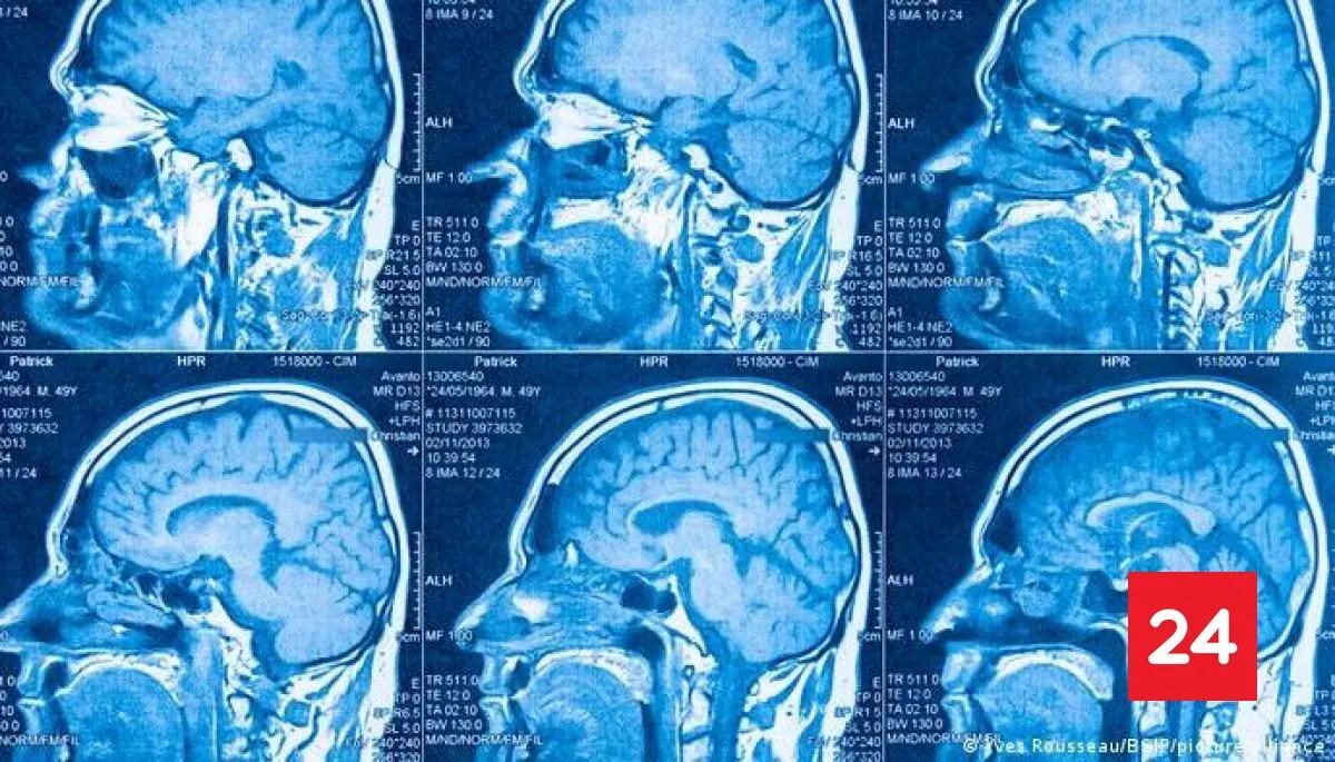 Scientists Find Two Brain Progenitor Cell Populations Expressing Otx2 And Gbx2