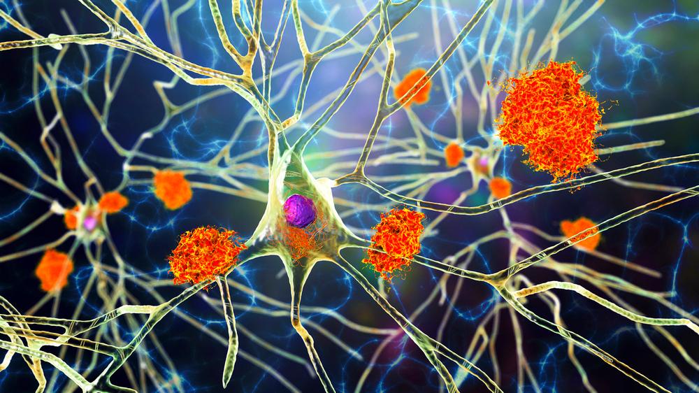 AI System From University of California, Davis Suggests Ingredient Substitutions To Improve Meals